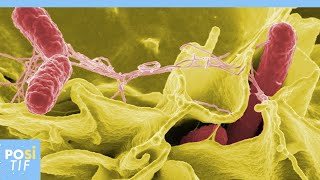 Comment savoir si vous avez été infecté par la salmonellose [upl. by Avictor353]