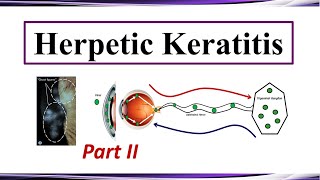 Herpetic Keratitis  Therapy Part II [upl. by Mohandis]