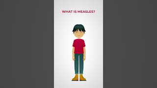 Whats the deal with measles [upl. by Tevlev]