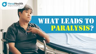 Know all about Paralysis  HexaHealth Expert Dr Sanjay Kumar Chaudhary [upl. by Alarick24]