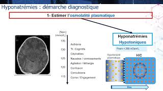 6 37 2 Hyponatrémie  démarche diagnostique diagnostic étiologique prise en charge [upl. by Delphina696]