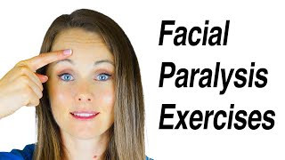 Facial Paralysis Exercises for Bells Palsy [upl. by Sami]