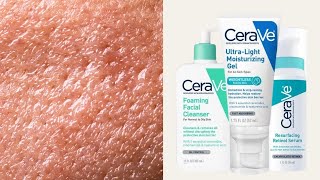 Top 5 CeraVe Skincare for Oily  Combination Skin Types [upl. by Suruat]