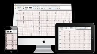 DEXTRONIX  How to use our wireless diagnostic VETECG [upl. by Ettelloc]