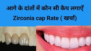 आगे के दांतों में कौन सी कैप लगाएँ कैप का खर्चा Zirconia cap rateE max costsmile design [upl. by Fullerton]