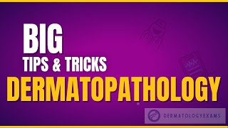 BIG Tips and Tricks for Histopathology dermatopathology  Dermatology Exam Preparation [upl. by Heurlin929]