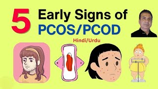 PCOS Symptoms amp Treatment Options pcos PolcysticOvarianSyndrome drabbasofficial [upl. by Peirce]