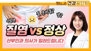 산부인과 의사가 알려주는 질염 vs 정상 질분비물 비교Tip [upl. by Mobley]