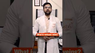 Varicose Veins Kya Hota Hai varicoseveins interventionalradiology [upl. by Elda]