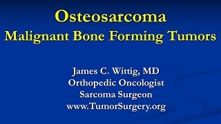 Orthopedic Oncology Course  Malignant Bone Forming Tumors Osteosarcoma  Lecture 4 [upl. by Nani]