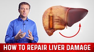 How To Repair Liver Damage After Alcohol – DrBerg on Liver Cirrhosis [upl. by Amliw141]