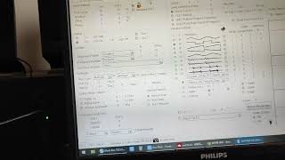 FY2300 frequency generator used with Spooky2 software [upl. by Gerhardt]