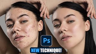 New Photoshop Trick Perfect Skin in Minutes – Acne Gone Smooth Skin with Simple Steps [upl. by Ahsot]