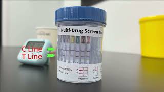 How To Read Urine Test Strips [upl. by Zachar]