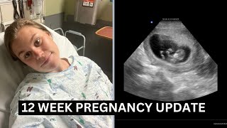 12 WEEK PREGNANCY UPDATE  IN THE ER  BLEEDING AT 12 WEEKS PREGNANT [upl. by Brandea184]