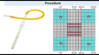 Total WBC counting by using hemocytometer  Neubaurs Chamber  urduhindi [upl. by Bille]