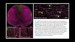 Uman type neurofilament light antibodies are effective reagents for the imaging of neurodegeneration [upl. by Anoet962]