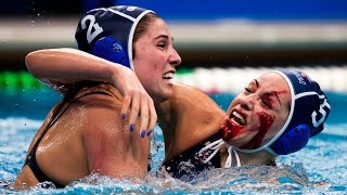 The Top 5 Most Devastating Water Polo Injuries of All Time [upl. by Keeley]