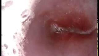 Reflux esophagitis in dog wwwendovetsu Russia  Kurgan [upl. by Melisse]