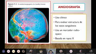 Técnicas Neuroimagen Estructural [upl. by Adnilram]