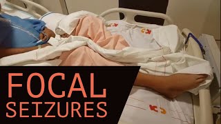 Focal seizures  Focal seizure epilepsy  Types of seizure [upl. by Eimilb]