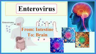 enterovirus [upl. by Cassey]