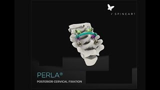 Spineart PERLA Posterior Cervical System [upl. by Tanah]