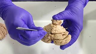 Dissection  Anatomy of Cerebellum [upl. by Ethan319]