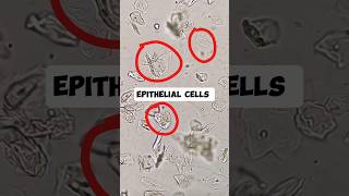 Epithelial cells in urine microscopy urine science shortsfeed shortsvideo shorts [upl. by Tien]