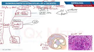 Nefrología  Glomerulonefritis rapidamente progresiva [upl. by Arihsak]