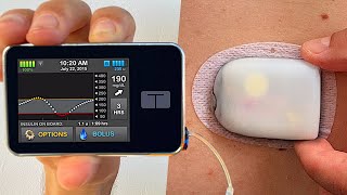 Omnipod 5 vs Tandem tslim x2  Full Test amp Review [upl. by Sherie]