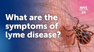 What are the symptoms of Lyme disease [upl. by Eirrod]