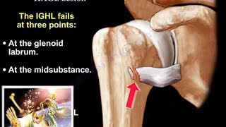 Lesions Of The Shoulder HAGL Lesion  Everything You Need To Know  Dr Nabil Ebraheim [upl. by Nala706]