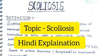 Scoliosis  Definition  Causes  Signs amp Symptoms  Diagnosis  Treatment [upl. by Verine]