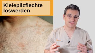 Kleiepilzflechte loswerden Schwitzpilz Pityriasis versicolor behandeln Dr Kasten Mainz [upl. by Tolkan]