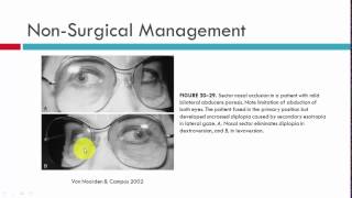 Principles of Managing Neurogenic Palsies [upl. by Grissel]