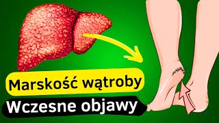 12 Pierwszych Objawów Uszkodzenia Wątroby  Przewodnik po Zdrowiu Wątroby [upl. by Nodnarb]