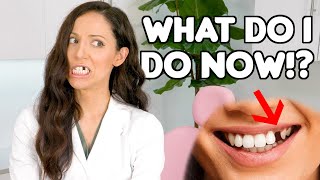 How To REPLACE A Missing Tooth Best Tooth Replacement Options [upl. by Alilahk]