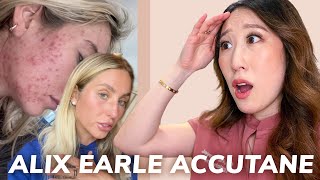 Dermatologist Reacts to Accutane Journey from Alix Earle  Side Effects Hair Loss Acne Recurrence [upl. by Aleetha773]