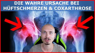 Die WAHRE Ursache bei Hüftschmerzen und Hüftarthrose Coxarthrose [upl. by Iggem]