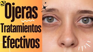 Ojeras Oscuras Como Quitarlas [upl. by Pappas]