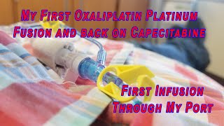 My First Oxaliplatin Platinum Fusion and back on Capecitabine [upl. by Zobe]