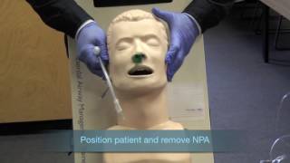 Nasotracheal Intubation [upl. by Elynad]