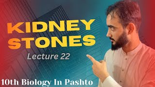 Kidney Stones  Disorder of Kidneys  How to Treat the kidney stones  Lecture 22 [upl. by Kawasaki868]