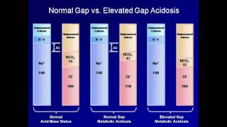 ABG Interpretation The Anion Gap Lesson 5 [upl. by Aslin]