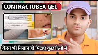 Contractubex gel uses dose benefits and side effects full review in hindi [upl. by Stella]