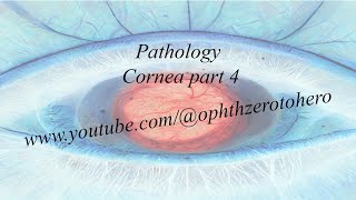 DrElkafrawy Pathology Cornea Part4 Other Ectasias amp Corneal Depositions [upl. by Martainn]