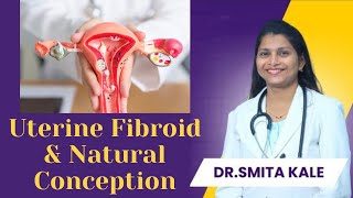 Success Story  Conceived naturally with Uterine Fibroids Dr Smita Kale [upl. by Cyrillus]