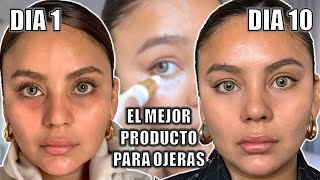 ELIMINO OJERAS EN 10 DIAS LA CREMA 1 DEL MUNDO DEMARTOLOGICO [upl. by Grannia300]