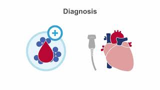 Endocarditis 101 Diagnosis and Treatment [upl. by Yevoc]